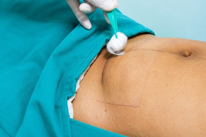 c-section-delivery-in-pune
